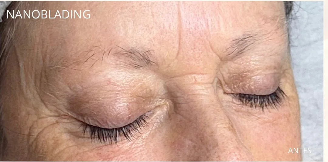 Cejas antes del tratamiento de nanoblading